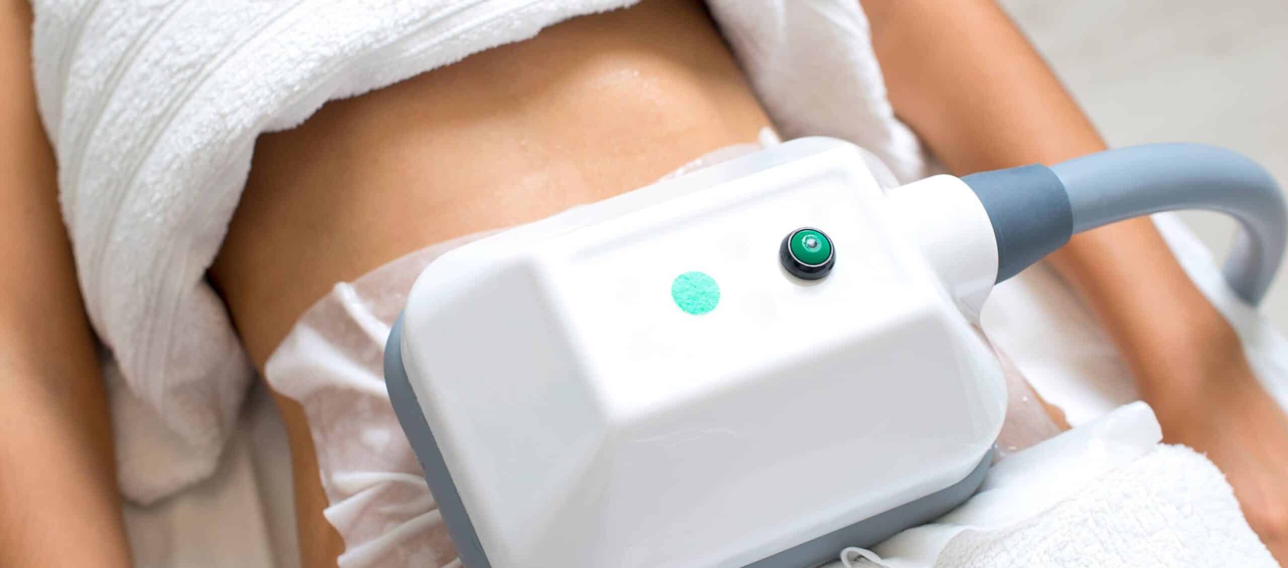 Combien coûte la cryolipolyse en France ? Tarifs 2026 par zone